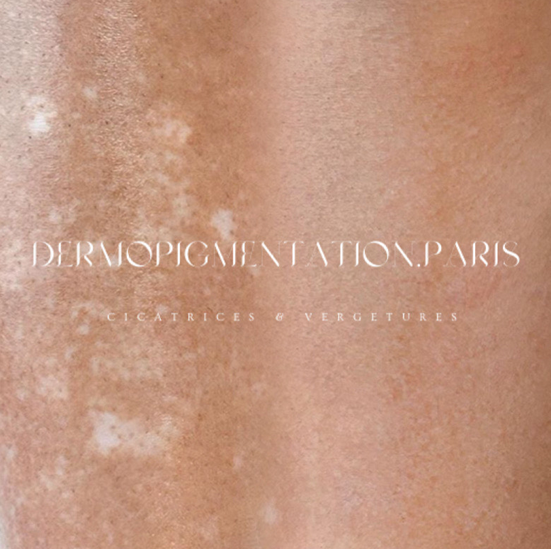 Résultat Dermopigmentation Paris : découvrez en images l’impact immédiat de nos soins de camouflage et maquillage permanent.